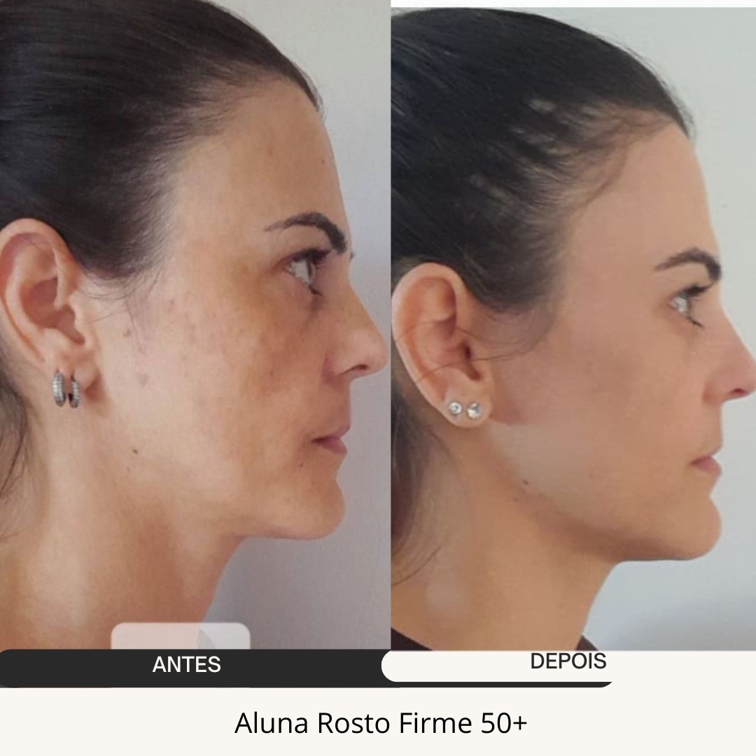 ANDREA ANTES E DEPOIS (1)