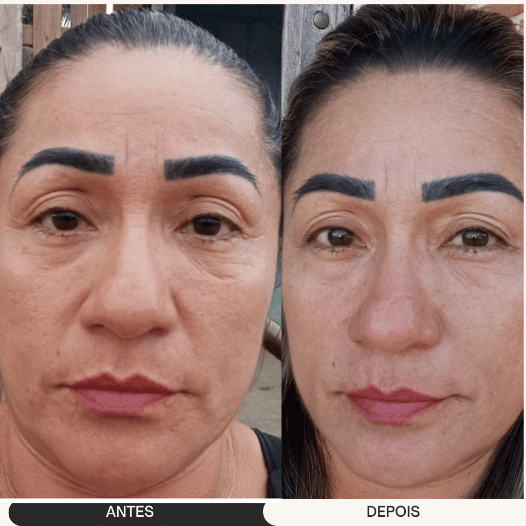 ANDREA ANTES E DEPOIS