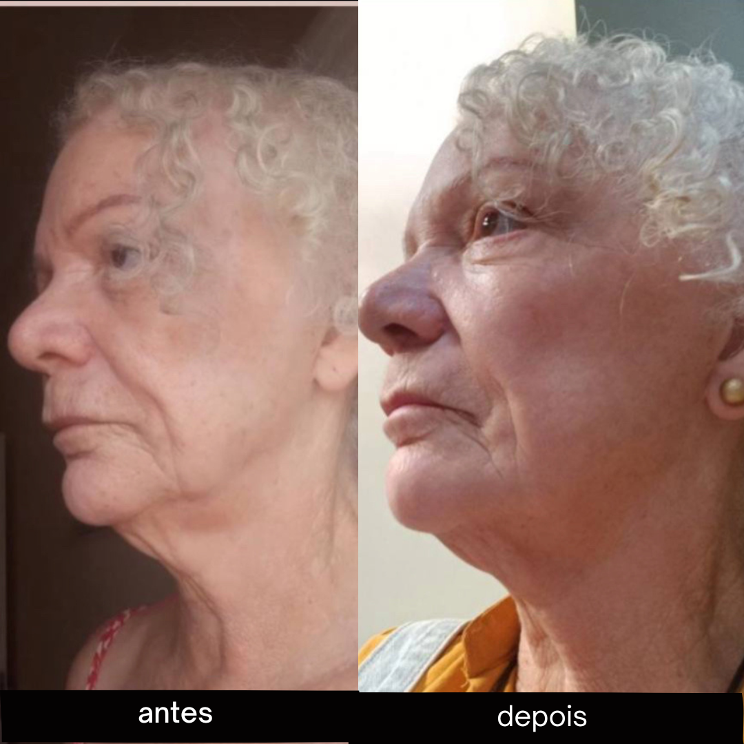 antes e depois alunas (1)