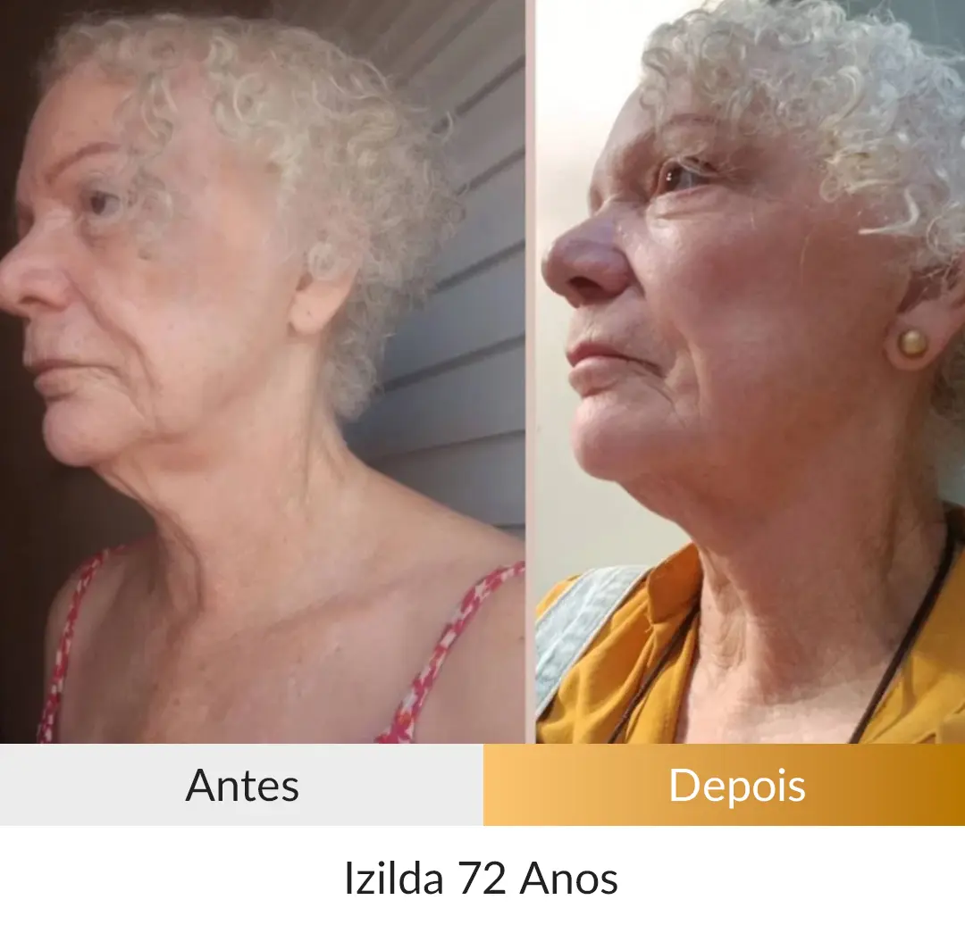 Izilda 72 anos