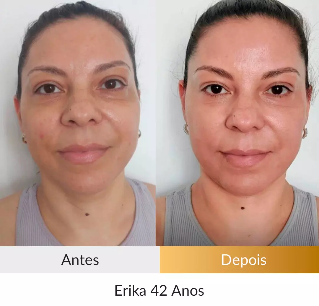 Transformação Erika 42 anos