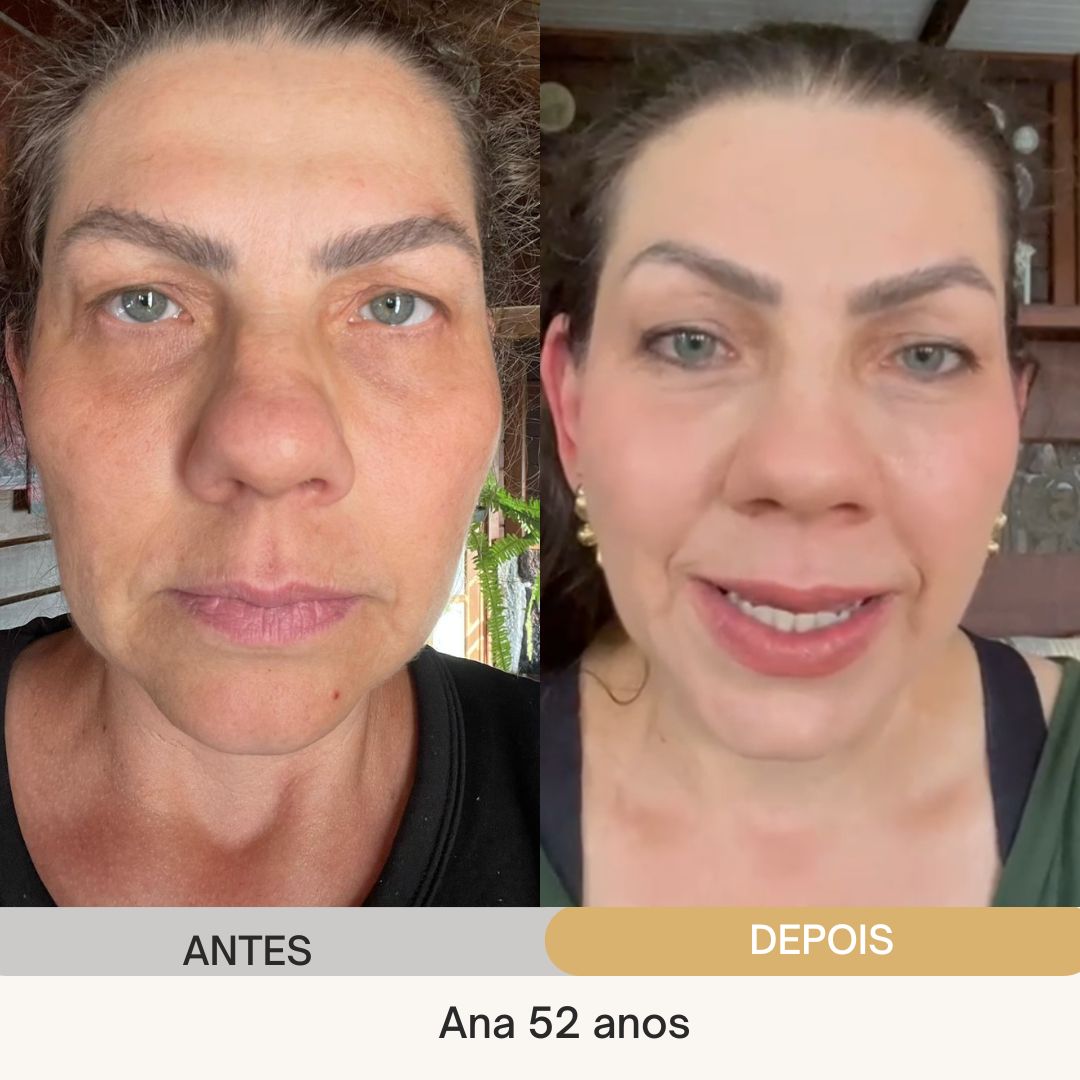 ANTES E DEPOIS (10)