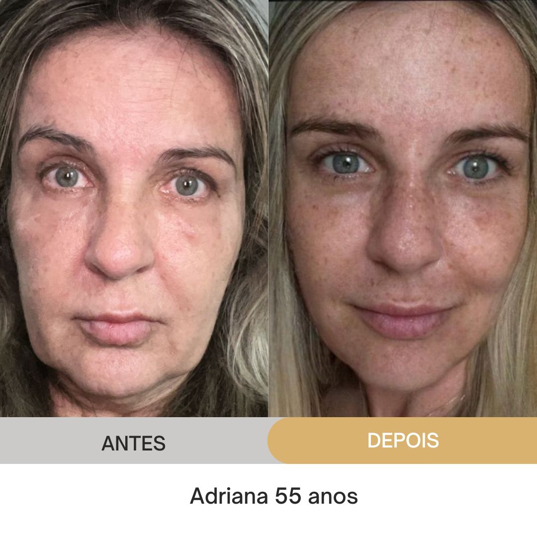 ANTES E DEPOIS (11)
