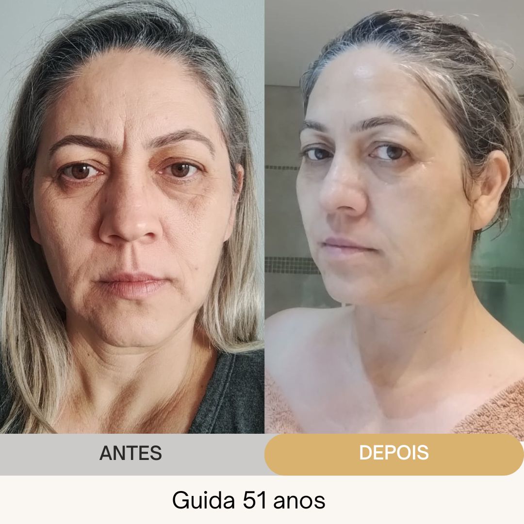 ANTES E DEPOIS (12)