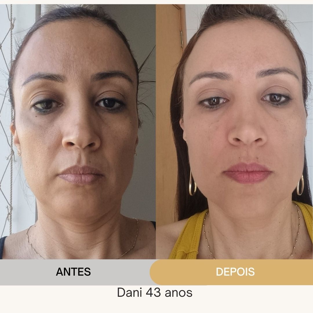 ANTES E DEPOIS (15)