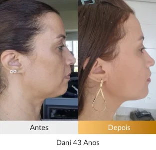 Dani 43 anos