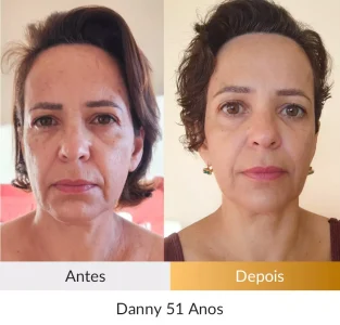 Depoimento Método Rosto Firme - Foto Danny 51 anos