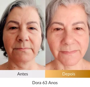 Depoimento Método Rosto Firme - Foto Dora 63 anos