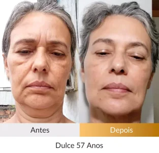 Depoimento Método Rosto Firme - Foto Dulce 57 anos