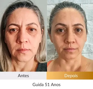 Depoimento Método Rosto Firme - Foto Guida 51 anos