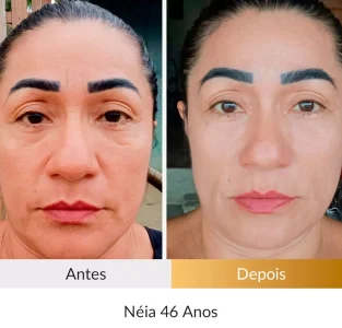 Depoimento Método Rosto Firme - Foto Néia 46 Anos