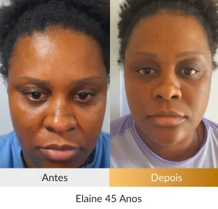 Elaine 45 anos