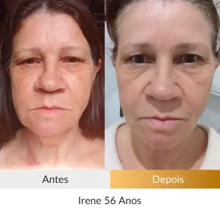 Irene 56 Anos