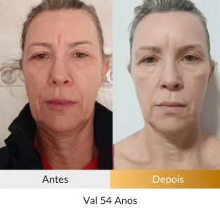 Val 54 anos